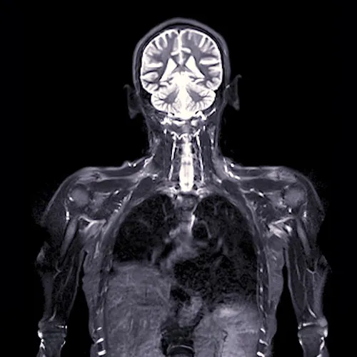 MRI scan visual showing upper body and brain